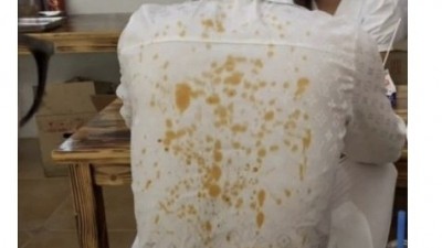 에취!!!