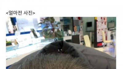 탈모약 후기 레전드
