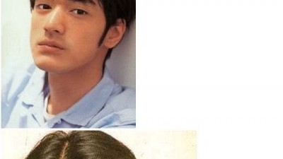 후천적 쌍꺼풀.