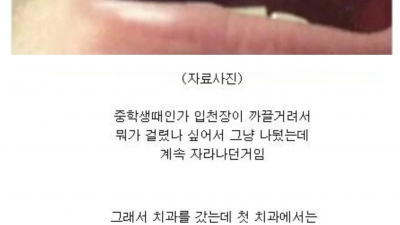 입천장에 뭐가 나서 치과에 갔더니